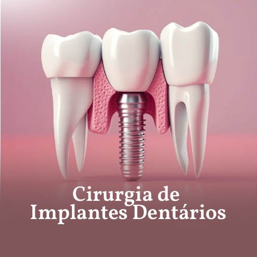 Cirurgia de implantes dentários