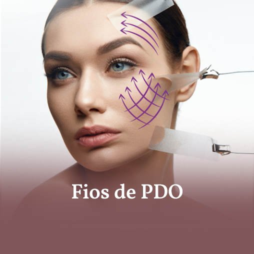 Fios de PDO